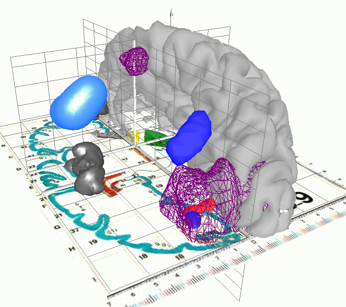 Matlab Fmri Tutorial