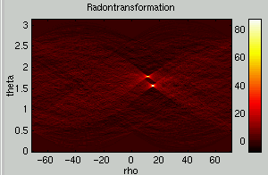 radon transform shown two spots bright